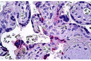Human Placenta: Formalin-Fixed, Parraffin-Embedded (FFPE) (DOK3 Antikörper  (AA 484-496))