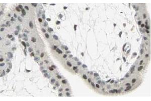 Image no. 2 for anti-SMAD, Mothers Against DPP Homolog 3 (SMAD3) (AA 417-425), (C-Term) antibody (ABIN401333) (SMAD3 Antikörper  (C-Term))