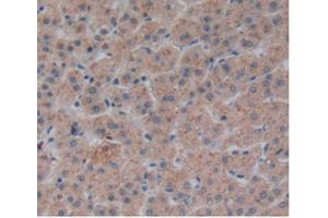 Immunohistochemistry (IHC) image for anti-Corin, Serine Peptidase (CORIN) (AA 134-573) antibody (ABIN7442108)