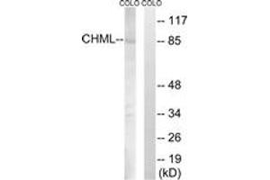Western blot analysis of extracts from COLO cells, using CHML Antibody.