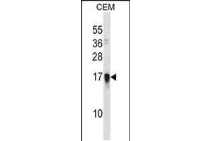Western blot analysis in CEM cell line lysates (35ug/lane). (FAM163A Antikörper  (AA 32-61))