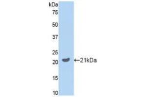 Western blot analysis of recombinant Mouse GAS6. (GAS6 Antikörper  (AA 483-646))