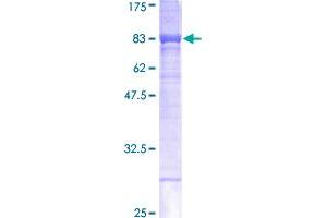 CES1 Protein (AA 1-566) (GST tag)