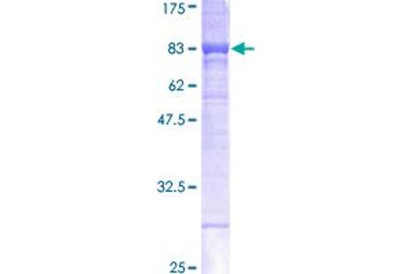 CES1 Protein (AA 1-566) (GST tag)