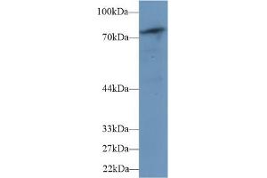 Detection of PLCd4 in Mouse Skeletal muscle lysate using Polyclonal Antibody to Phospholipase C Delta 4 (PLCd4)