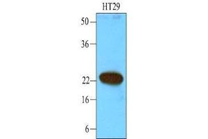 Cell lysates of HT29 (40 ug) were resolved by SDS-PAGE, transferred to nitrocellulose membrane and probed with anti-human CIB1 (1:1000). (CIB1 Antikörper  (AA 1-191))