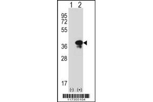Western blot analysis of STX3 using rabbit polyclonal STX3 Antibody using 293 cell lysates (2 ug/lane) either nontransfected (Lane 1) or transiently transfected (Lane 2) with the STX3 gene. (STX3 Antikörper  (AA 178-205))
