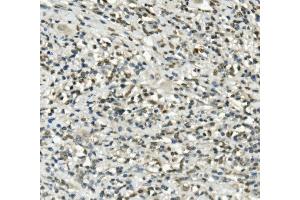 IHC analysis of UBE3A using anti-UBE3A antibody (ABIN7599562). (ube3a Antikörper  (AA 1-860))