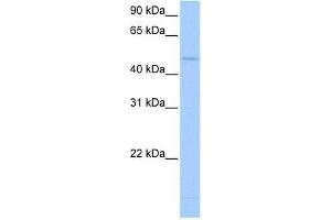 Western Blot showing RBM45 antibody used at a concentration of 1-2 ug/ml to detect its target protein. (RBM45 Antikörper  (Middle Region))