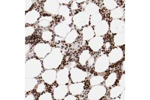 Immunohistochemical staining of human NFE2 polyclonal antibody  shows strong nuclear positivity in bone marrow poietic cells at 1:50-1:200 dilution. (NFE2 Antikörper)