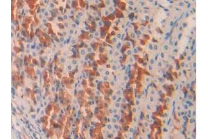 DAB staining on IHC-P; Samples: Rat Stomach Tissue (COL2A1 Antikörper  (AA 1226-1331))