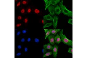 ABIN7094276 and ABIN7098323 staining Hela cells by IF/ICC. (Histone Cluster 1, H1t (HIST1H1T) (Internal Region) Antikörper)