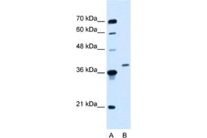 Western Blotting (WB) image for anti-Homeobox D11 (HOXD11) antibody (ABIN2460335) (HOXD11 Antikörper)
