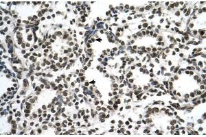 Human Lung; ZNF706 antibody - N-terminal region in Human Lung cells using Immunohistochemistry (ZNF706 Antikörper  (N-Term))