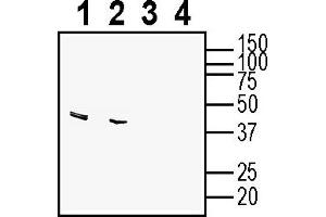 anti-Galanin Receptor 1 (GALR1) (AA 60-71), (Extracellular) antibody