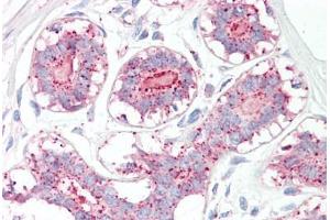 Image no. 2 for anti-Melanoma Antigen Family A, 1 (Directs Expression of Antigen MZ2-E) (MAGEA1) (AA 38-87) antibody (ABIN6749734) (MAGEA1 Antikörper  (AA 38-87))
