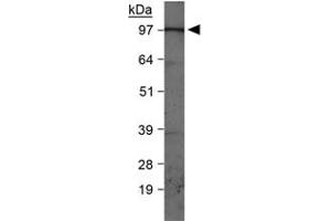Western blot analysis of PIK3C3 in HepG2 whole cell lysates with PIK3C3 polyclonal antibody . (PIK3C3 Antikörper  (AA 700-850))