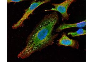Indirect immunostaining of HELA cells with anti-syntaxin 18 (dilution 1 : 100; green) and anti-α-tubulin (, dilution 1 : 100; red).