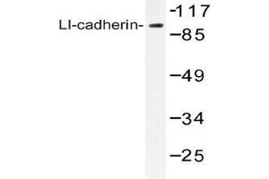 Western blot (WB) analysis of LI-cadherin antibody in extracts from Jurkat cells. (LI Cadherin Antikörper)