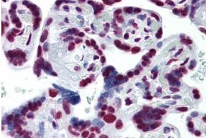 Human Placenta: Formalin-Fixed, Paraffin-Embedded (FFPE) (CDKL1 Antikörper  (AA 259-358))