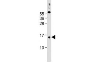 Western blot testing of human PC-3 cell lysate with SYNJBP antibody at 1:2000.