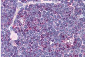 Human Thymus (formalin-fixed, paraffin-embedded) stained with CD99 antibody ABIN239808 at 10 ug/ml followed by biotinylated anti-mouse IgG secondary antibody ABIN481714, alkaline phosphatase-streptavidin and chromogen. (CD99 Antikörper)
