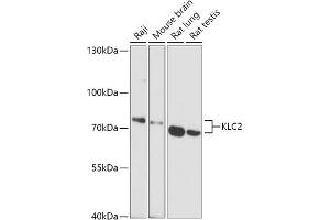 Western blot analysis of extracts of various cell lines, using KLC2 antibody (ABIN7268140) at 1:1000 dilution. (KLC2 Antikörper  (AA 1-90))