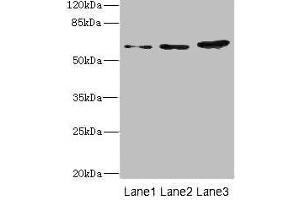 Western blot All lanes: ERVFRD-1 antibody at 3. (HERV-FRD Provirus Ancestral Env Polyprotein (Herv-frd) (AA 16-250) Antikörper)