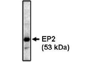 Western Blotting (WB) image for anti-Prostaglandin E Receptor 2 (Subtype EP2), 53kDa (PTGER2) antibody (ABIN264447) (PTGER2 Antikörper)