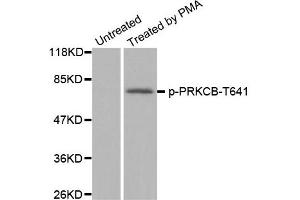 Western Blotting (WB) image for anti-Protein Kinase C, beta (PRKCB) (pThr641) antibody (ABIN1870521) (PKC beta Antikörper  (pThr641))