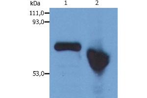 Western Blotting analysis of human alpha-Fetoprotein in Hep G2 human hepatocellular carcinoma cell line. (alpha Fetoprotein Antikörper)