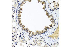 Immunohistochemistry of paraffin-embedded mouse lung using IFNL1 antibody at dilution of 1:100 (40x lens). (IL29 Antikörper)