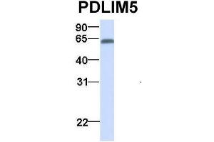 Western Blotting (WB) image for anti-PDZ and LIM Domain 5 (PDLIM5) (N-Term) antibody (ABIN2780775)