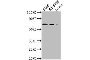 Western Blot Positive WB detected in: HL60 whole cell lysate, SH-SY5Y whole cell lysate, Mouse liver tissue All lanes: PTGS1 antibody at 1:2000 Secondary Goat polyclonal to rabbit IgG at 1/50000 dilution Predicted band size: 69, 65, 62, 57, 72, 73 kDa Observed band size: 72 kDa (Rekombinanter PTGS1 Antikörper)