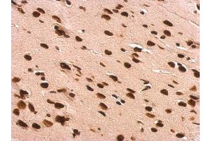 Immunohistochemistry (IHC) image for anti-Growth Factor Receptor-Bound Protein 2 (GRB2) (C-Term) antibody (ABIN2854697)