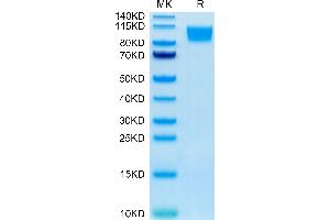 SDS-PAGE (SDS) image for Guanylate Cyclase 2C (Heat Stable Enterotoxin Receptor) (GUCY2C) (AA 24-430) protein (Fc Tag) (ABIN7274715)