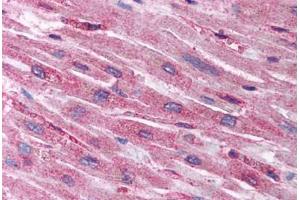 Human Heart (formalin-fixed, paraffin-embedded) stained with HIF1AN antibody ABIN214112 at 5 ug/ml followed by biotinylated goat anti-rabbit IgG secondary antibody ABIN481713, alkaline phosphatase-streptavidin and chromogen. (HIF1AN Antikörper  (N-Term))