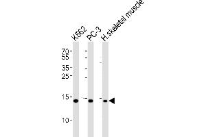 Western blot analysis of lysates from K562, PC-3 cell line and human skeletal muscle tissue lysate(from left to right), using HIST1H2BM Antibody (N-term) (ABIN6243575 and ABIN6577461). (HIST1H2BM Antikörper  (N-Term))