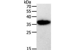 Western Blot analysis of A549 cell using PLAUR Polyclonal Antibody at dilution of 1:450 (PLAUR Antikörper)