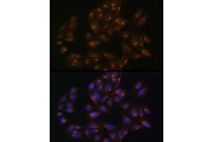 Immunofluorescence analysis of U-2 OS cells using SNX1 Rabbit pAb (ABIN6128725, ABIN6148234, ABIN6148235 and ABIN6224727) at dilution of 100 (40x lens).