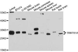 Western blot analysis of extracts of various cell lines, using TRMT61A antibody (ABIN5999106) at 1/1000 dilution. (TRMT61A Antikörper)