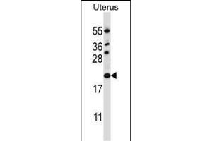 CDKN1B Antibody (C-term) (ABIN657225 and ABIN2846327) western blot analysis in human normal Uterus tissue lysates (35 μg/lane). (CDKN1B Antikörper  (C-Term))