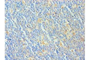 Immunohistochemistry of paraffin-embedded human tonsil tissue using ABIN7173325 at dilution of 1:100 (TCOF1 Antikörper  (AA 1189-1488))