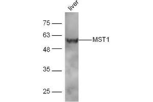 Mouse liver lysates probed with Rabbit Anti-MST1 Polyclonal Antibody, Unconjugated  at 1:5000 for 90 min at 37˚C. (MST1 Antikörper  (AA 385-487))