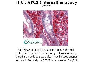 Image no. 2 for anti-APC Regulator of WNT Signaling Pathway 2 (APC2) (Internal Region) antibody (ABIN1731845) (APC2 Antikörper  (Internal Region))