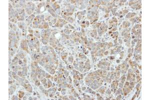 Immunohistochemistry (IHC) image for anti-Enhancer of mRNA Decapping 3 (EDC3) (Internal Region) antibody (ABIN2857007)