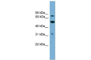 TLK2 antibody used at 0. (TLK2 Antikörper  (N-Term))