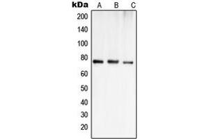 Western blot analysis of OATP1 expression in Jurkat (A), MCF7 (B), SHSY5Y (C) whole cell lysates. (SLCO1A2 Antikörper  (Center))