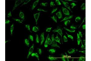Immunofluorescence of monoclonal antibody to TOMM20 on HeLa cell.