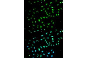 Immunofluorescence analysis of MCF7 cell using CD27 antibody. (CD27 Antikörper  (AA 20-191))